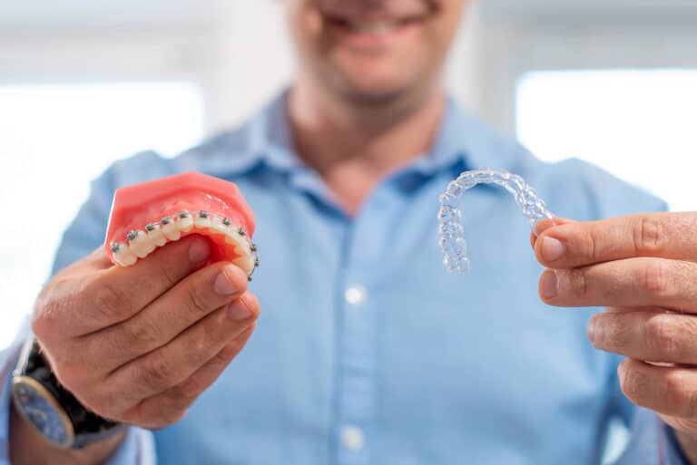 Aligners And Braces in Johns Creek GA